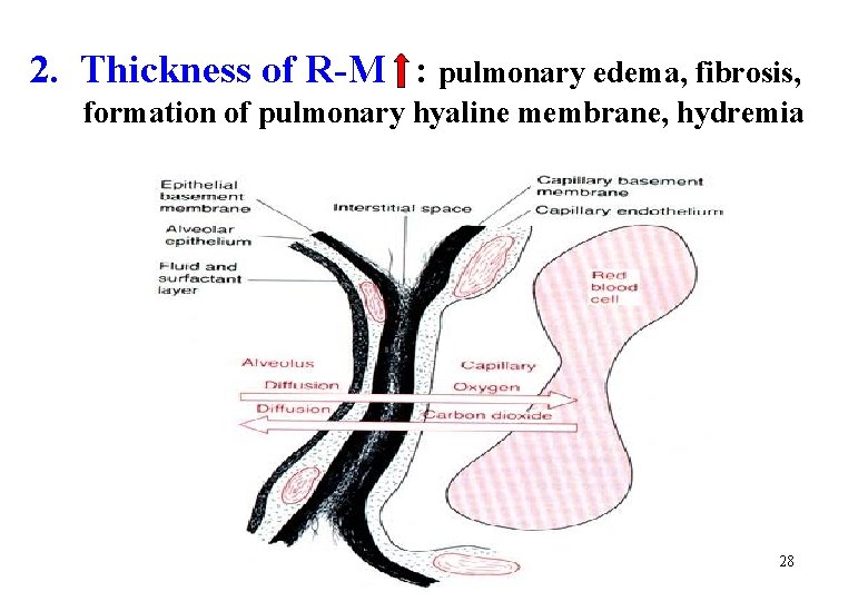 2. Thickness of R-M : pulmonary edema, fibrosis, formation of pulmonary hyaline membrane, hydremia