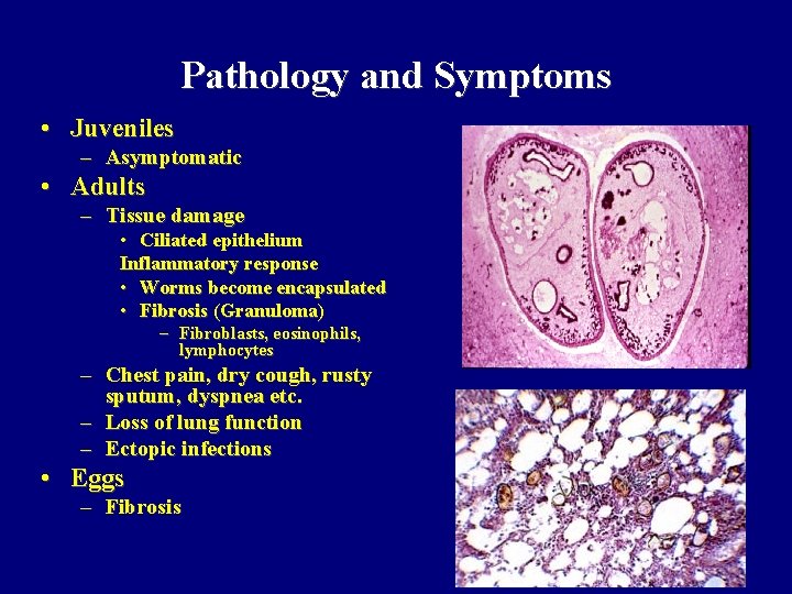 paragonimus-spp-paragonimus-westermani-definitive-hosts-paragonimus