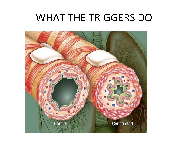 WHAT THE TRIGGERS DO 