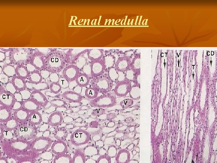 Renal medulla 