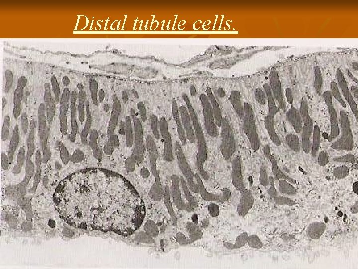 Distal tubule cells. 