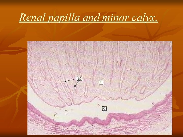 Renal papilla and minor calyx. 