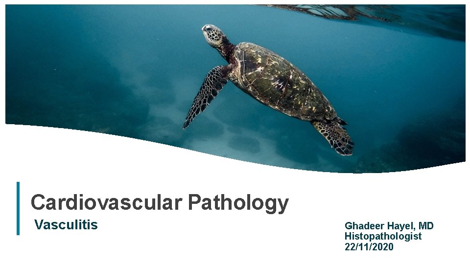 Cardiovascular Pathology Vasculitis Ghadeer Hayel, MD Histopathologist 22/11/2020 1 