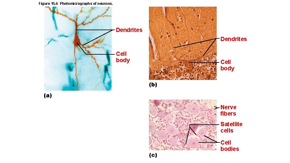 Figure 15. 6 Photomicrographs of neurons. Dendrites Cell body Nerve fibers Satellite cells Cell