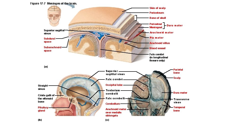 Figure 17 -7 Meninges of the brain. Skin of scalp Periosteum Bone of skull