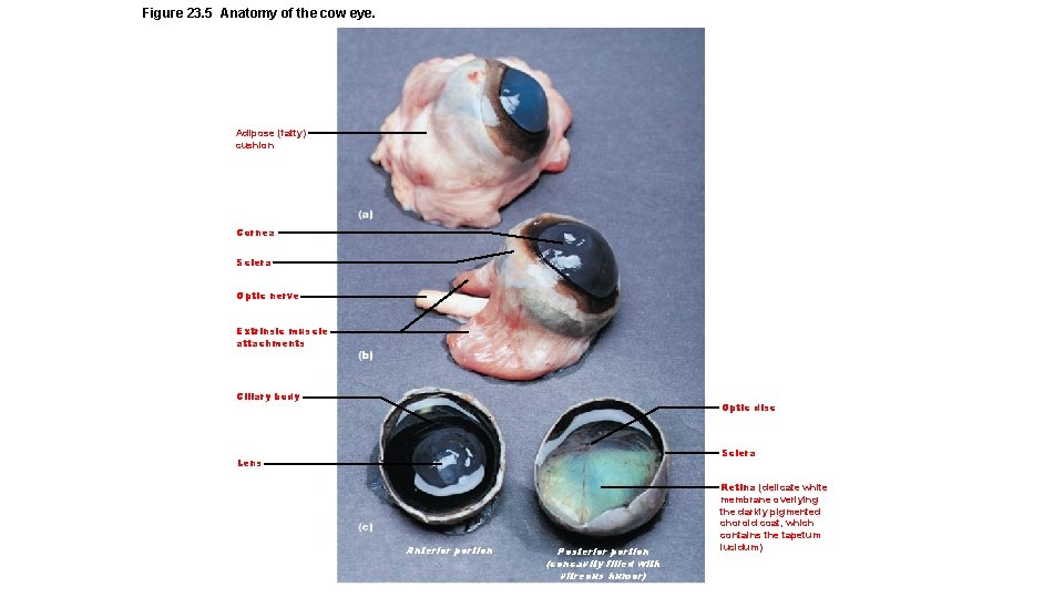 Figure 23. 5 Anatomy of the cow eye. Adipose (fatty) cushion Cornea Sclera Optic