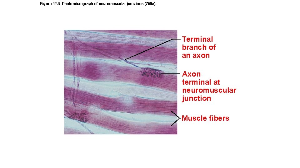 Figure 12. 6 Photomicrograph of neuromuscular junctions (750 ). Terminal branch of an axon