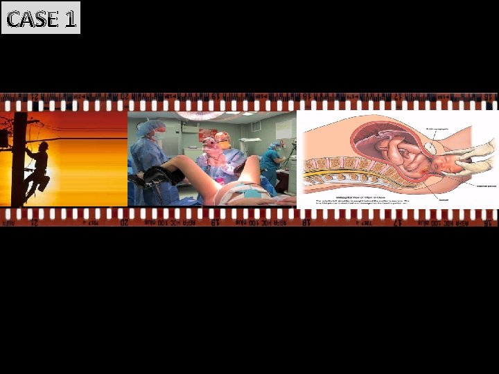 CASE 1 