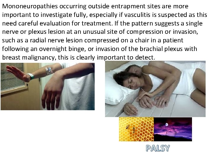 Mononeuropathies occurring outside entrapment sites are more important to investigate fully, especially if vasculitis