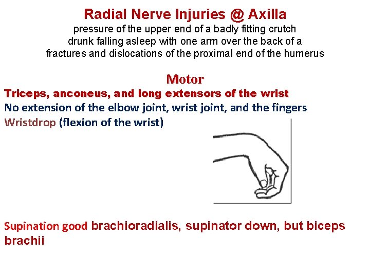 Radial Nerve Injuries @ Axilla pressure of the upper end of a badly fitting