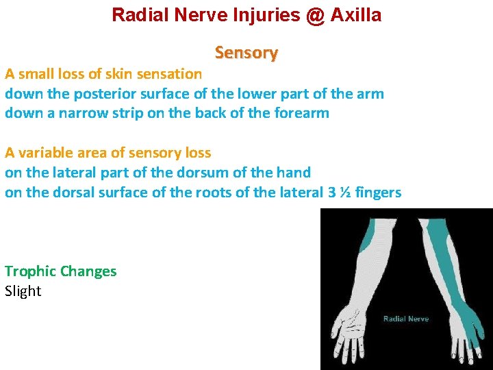 Radial Nerve Injuries @ Axilla Sensory A small loss of skin sensation down the