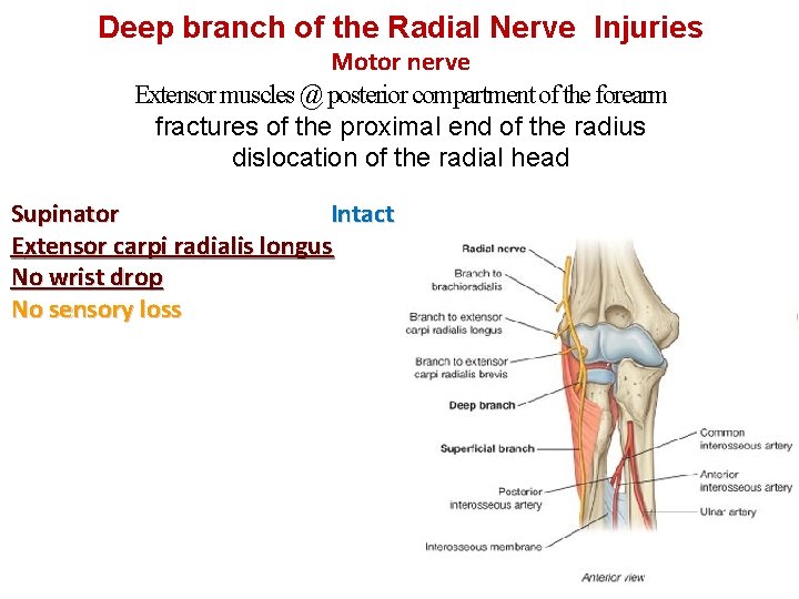 Deep branch of the Radial Nerve Injuries Motor nerve Extensor muscles @ posterior compartment