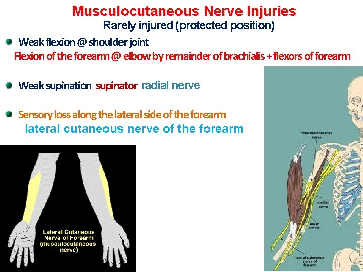 Musculocutaneous Nerve Injuries Rarely injured (protected position) Weak flexion @ shoulder joint Flexion of