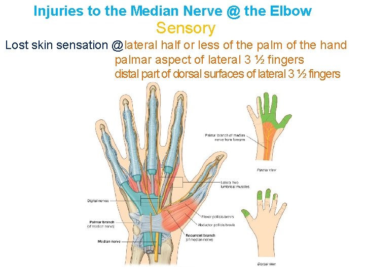 Injuries to the Median Nerve @ the Elbow Sensory Lost skin sensation @lateral half