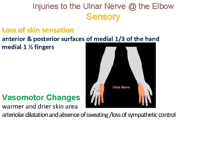 Injuries to the Ulnar Nerve @ the Elbow Sensory Loss of skin sensation anterior