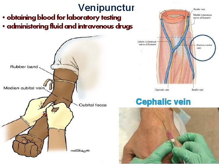 Venipuncture • obtaining blood for laboratory testing • administering fluid and intravenous drugs Cephalic