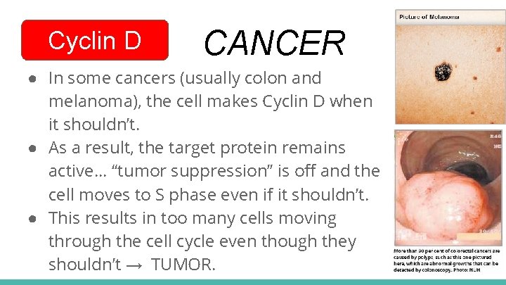 Cyclin D CANCER ● In some cancers (usually colon and melanoma), the cell makes