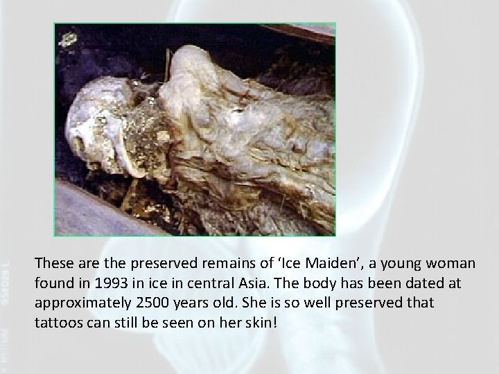 These are the preserved remains of ‘Ice Maiden’, a young woman found in 1993
