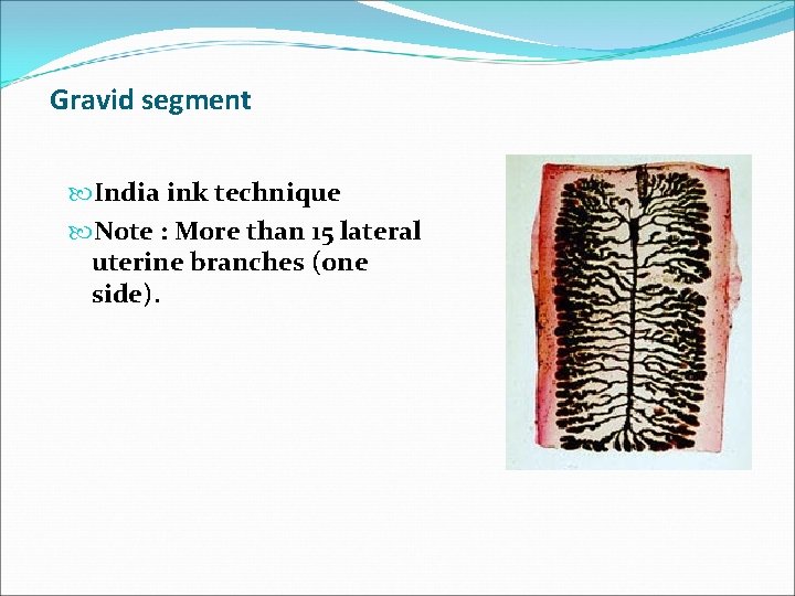 Gravid segment India ink technique Note : More than 15 lateral uterine branches (one