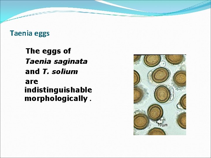 Taenia eggs The eggs of Taenia saginata and T. solium are indistinguishable morphologically. 