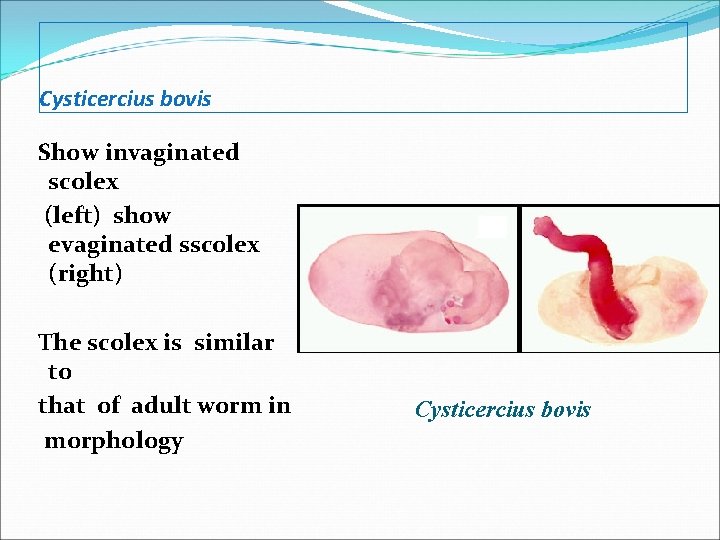 Cysticercius bovis Show invaginated scolex (left) show evaginated sscolex (right) The scolex is similar