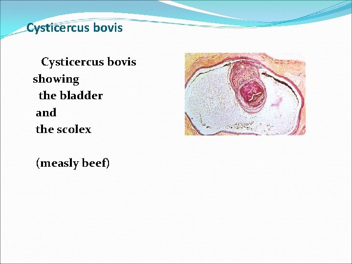 Cysticercus bovis showing the bladder and the scolex (measly beef) 