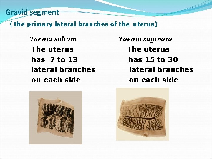 Gravid segment ( the primary lateral branches of the uterus) Taenia solium The uterus