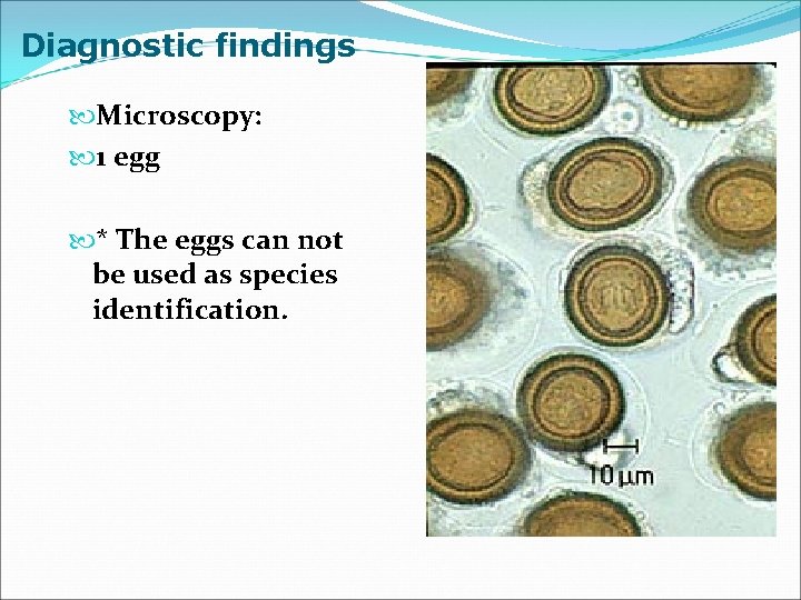 Diagnostic findings Microscopy: 1 egg * The eggs can not be used as species