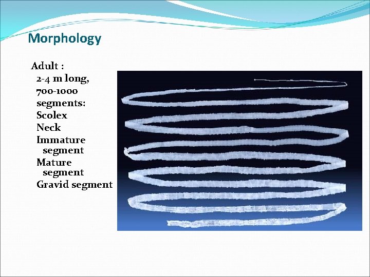 Morphology Adult : 2 -4 m long, 700 -1000 segments: Scolex Neck Immature segment