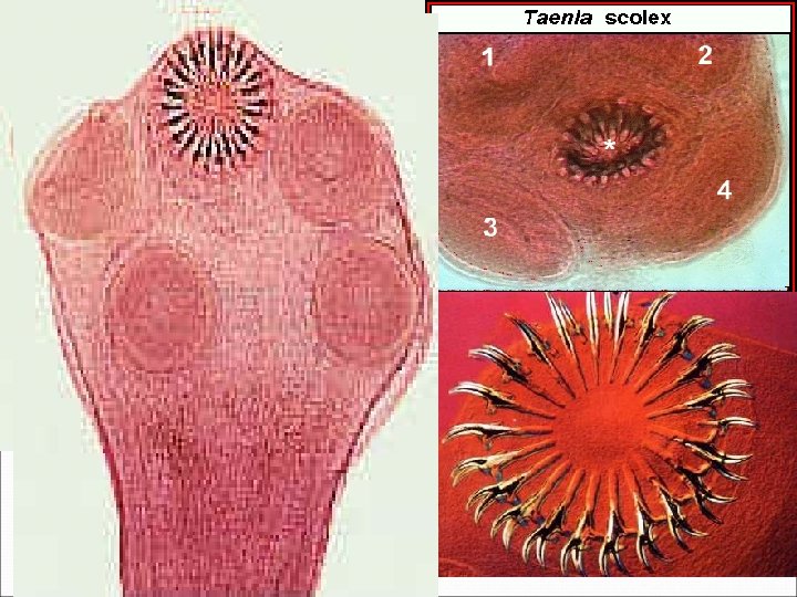 scolex 