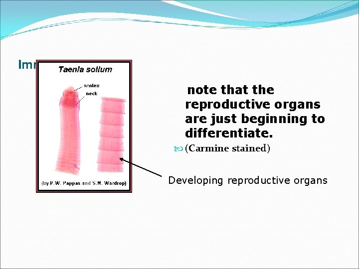 Immature segment note that the reproductive organs are just beginning to differentiate. (Carmine stained)
