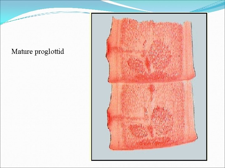 Mature proglottid 