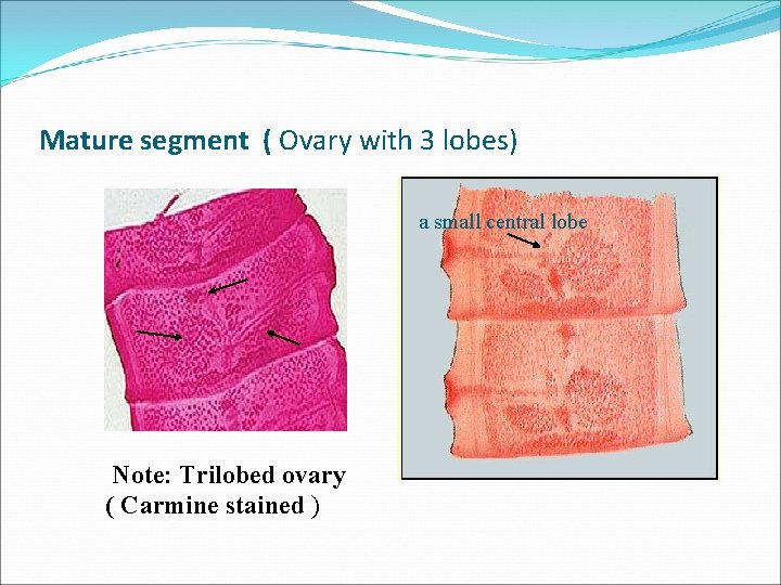 Mature segment ( Ovary with 3 lobes) a small central lobe Note: Trilobed ovary