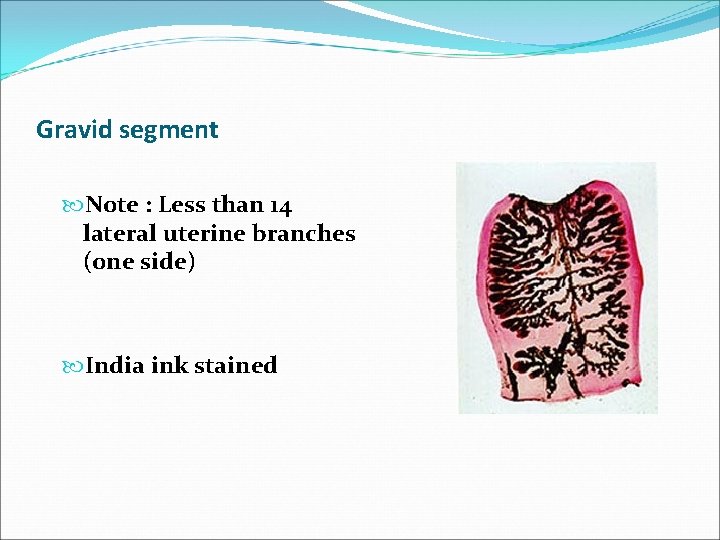 Gravid segment Note : Less than 14 lateral uterine branches (one side) India ink