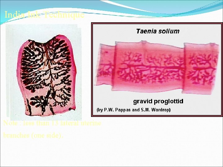India Ink Technique Note : less than 13 lateral uterine branches (one side). 