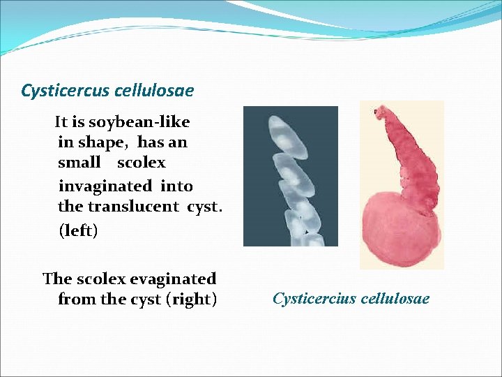 Cysticercus cellulosae It is soybean-like in shape, has an small scolex invaginated into the