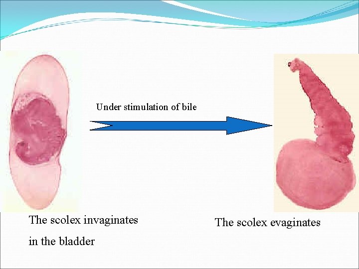 Under stimulation of bile The scolex invaginates in the bladder The scolex evaginates 