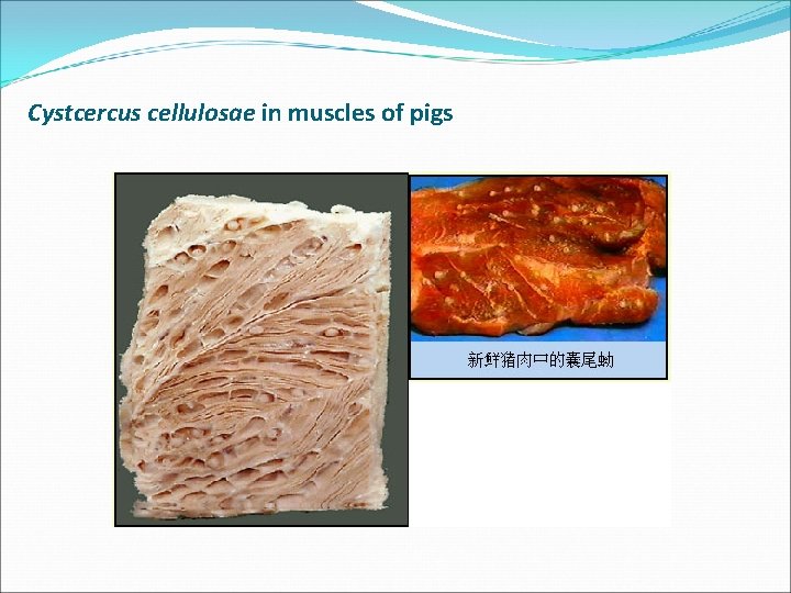 Cystcercus cellulosae in muscles of pigs 