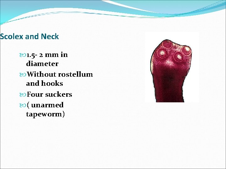 Scolex and Neck 1. 5 - 2 mm in diameter Without rostellum and hooks