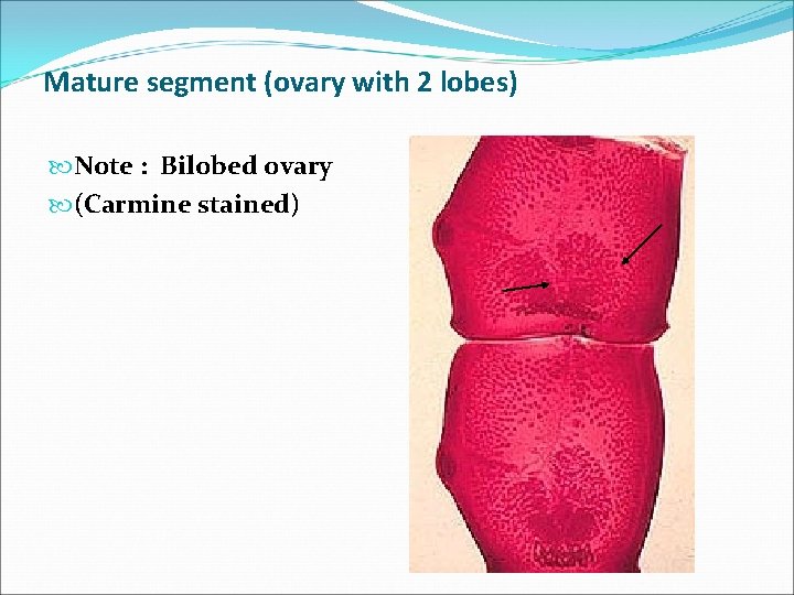 Mature segment (ovary with 2 lobes) Note : Bilobed ovary (Carmine stained) 