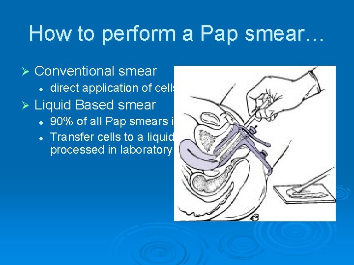 How to perform a Pap smear… Ø Conventional smear l Ø direct application of