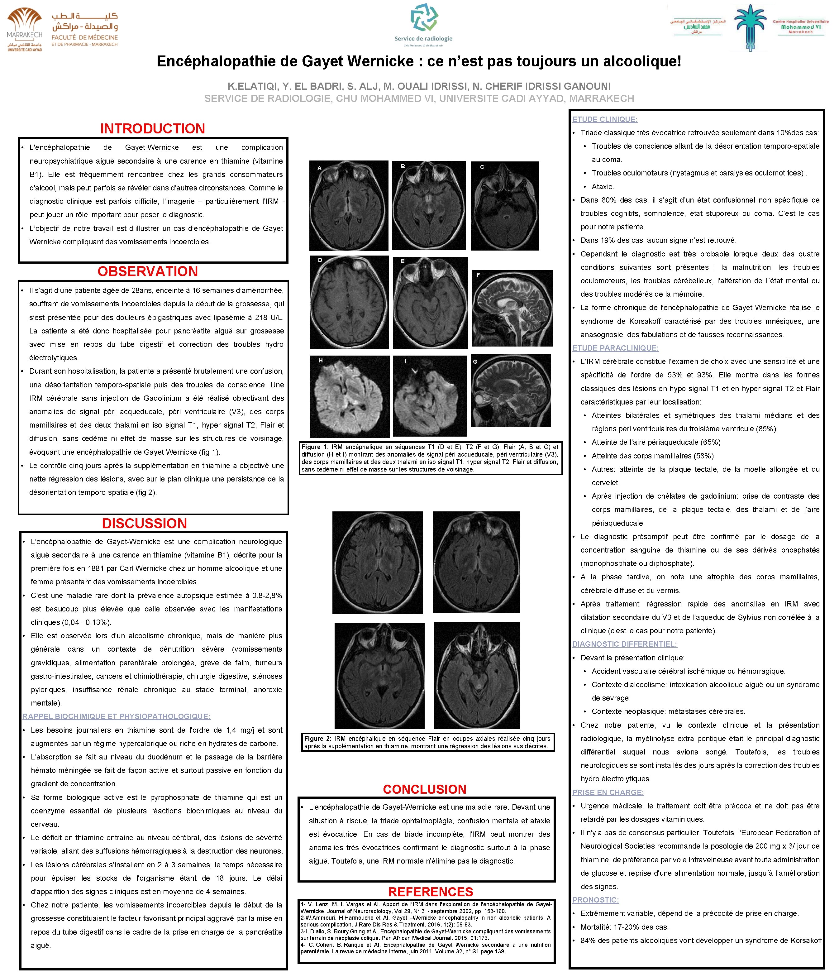 Encéphalopathie de Gayet Wernicke : ce n’est pas toujours un alcoolique! K. ELATIQI, Y.