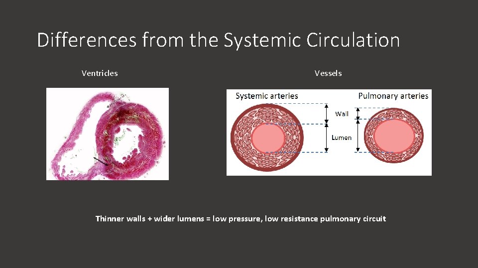 Differences from the Systemic Circulation Ventricles Vessels Thinner walls + wider lumens = low