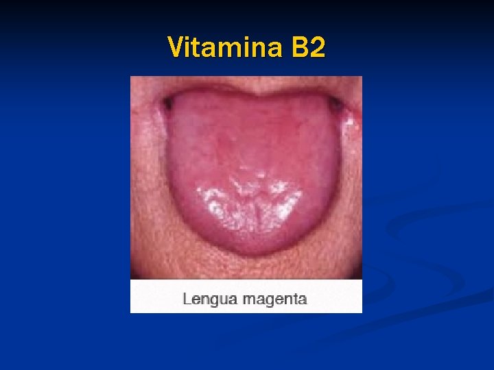 Vitamina B 2 