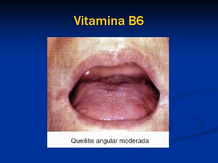 Vitamina B 6 