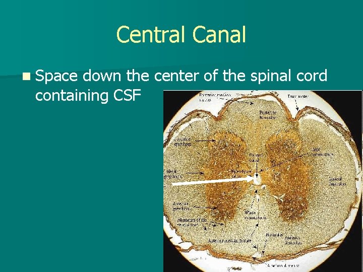 Central Canal n Space down the center of the spinal cord containing CSF 