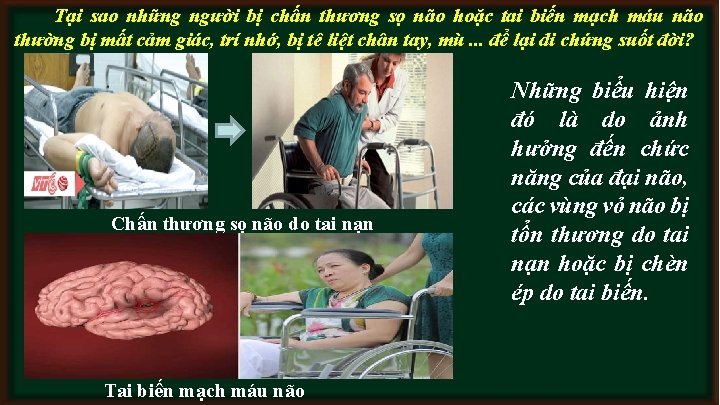 Tại sao những người bị chấn thương sọ não hoặc tai biến mạch máu