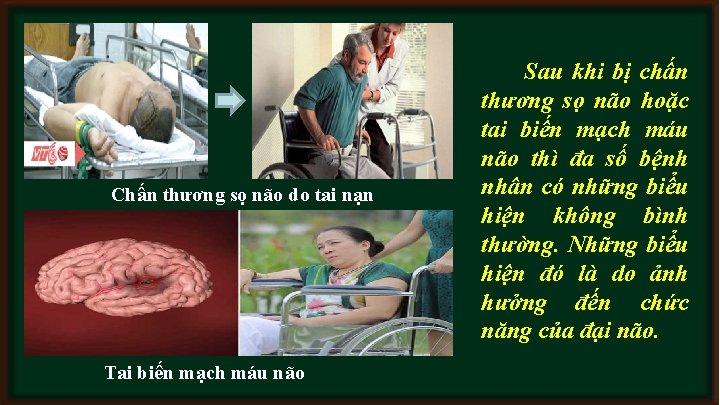 Chấn thương sọ não do tai nạn Tai biến mạch máu não Sau khi