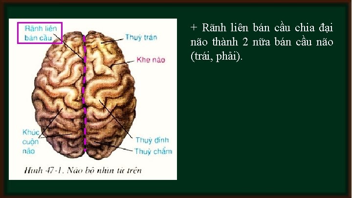 + Rãnh liên bán cầu chia đại não thành 2 nữa bán cầu não