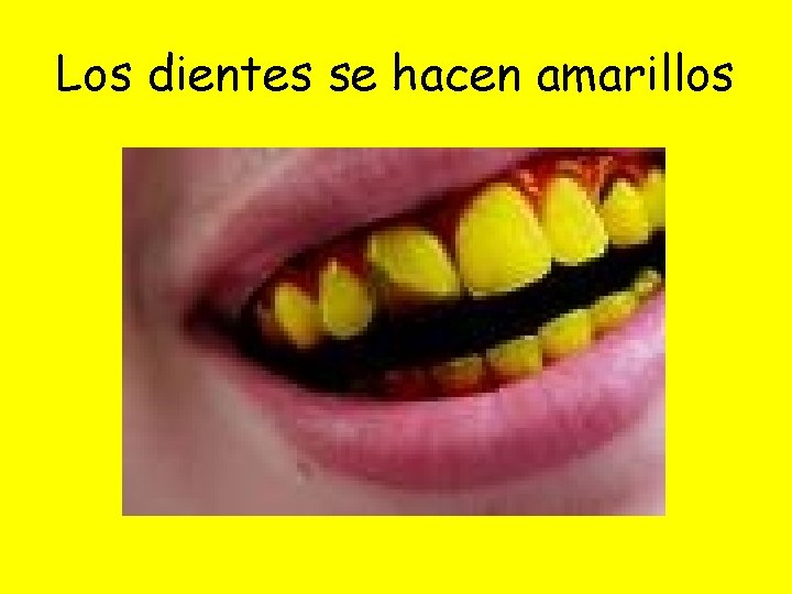 Los dientes se hacen amarillos 